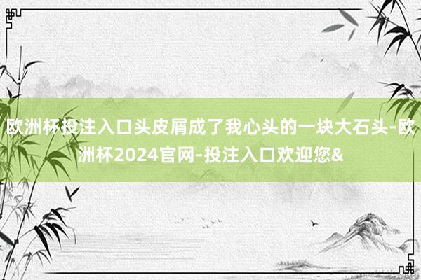 歐洲杯投注入口頭皮屑成了我心頭的一塊大石頭-歐洲杯2024官網-投注入口歡迎您&